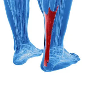Therapeutische Übungen zur Behandlung von Achillisproblemen.
