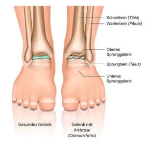 Therapeut lindert Beschwerden mit speziellen Massagetechniken.