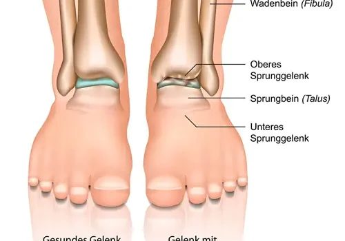 Therapeut lindert Beschwerden mit speziellen Massagetechniken.