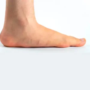 Therapiemassnahmen zur Linderung von Plattfussschmerzen