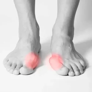 Therapiemassnahmen zur Schmerzlinderung bei Hallux.